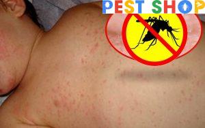 TÁC HẠI DO MUỖI GÂY RA